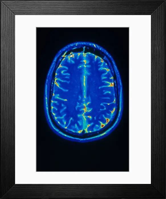Framed Print : MRI of Brain Framed Print : MRI of Brain