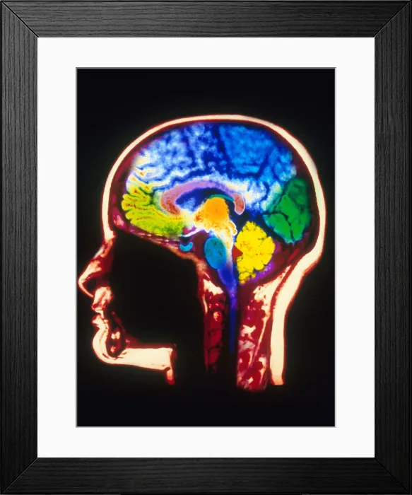 Framed Print : MRI of Head Framed Print : MRI of Head
