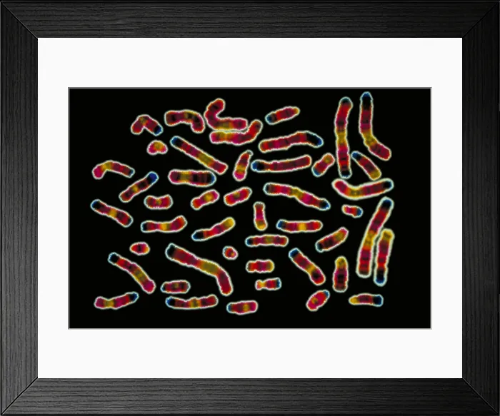 Framed Print : Karyotype of human chromosomes