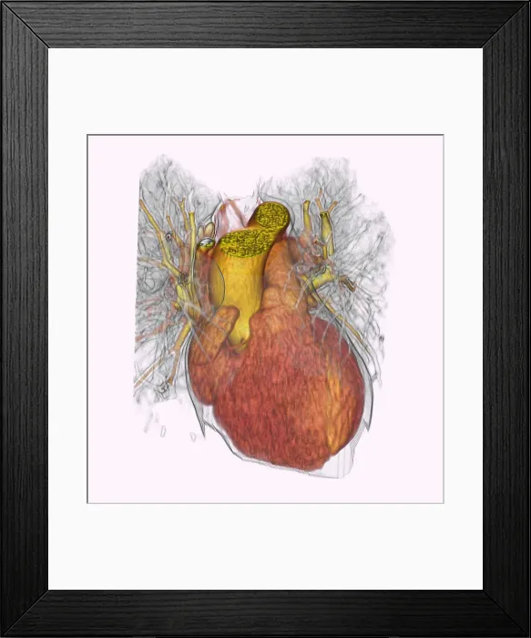 Framed Print : Heartbeat Sequence Illustration 1 Framed Print : Heartbeat Sequence Illustration 1
