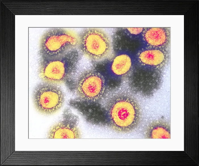 Framed Print : TEM of Coronavirus OC43 Framed Print : TEM of Coronavirus OC43