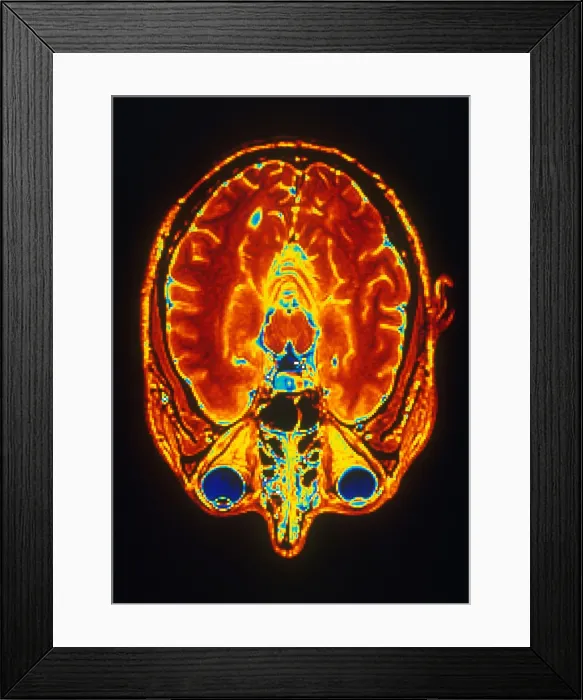 Framed Print : MRI of Brain Framed Print : MRI of Brain