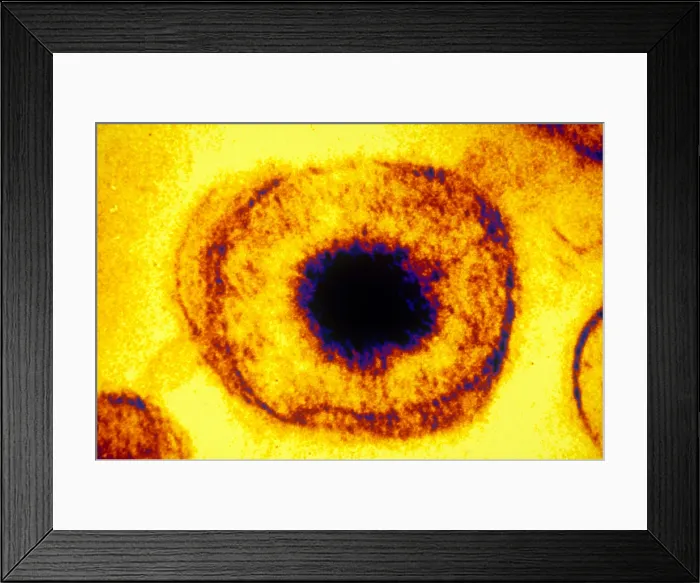 Framed Print : Herpes Simplex Virus (TEM)