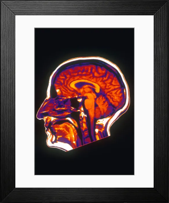 Framed Print : MRI of Brain Framed Print : MRI of Brain