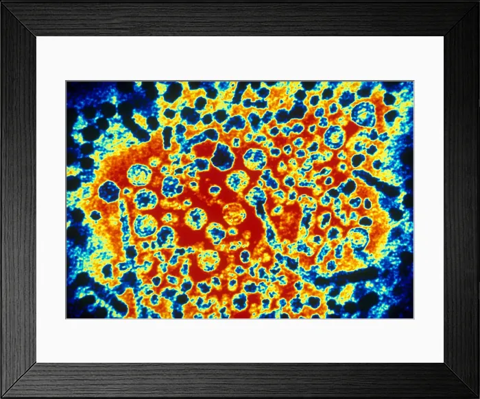 Framed Print : Hepatitis B Virus (TEM) Framed Print : Hepatitis B Virus (TEM)