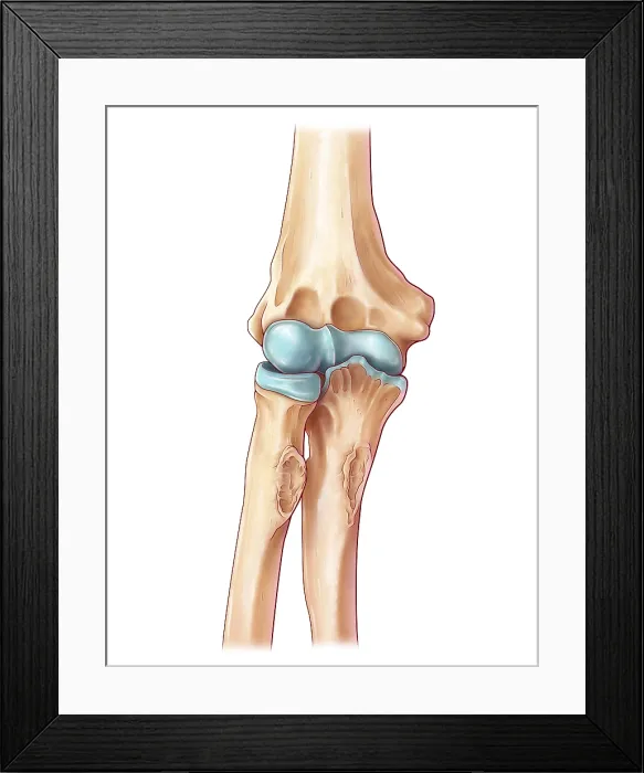 Framed Print : Elbow Joint, illustration Framed Print : Elbow Joint, illustration