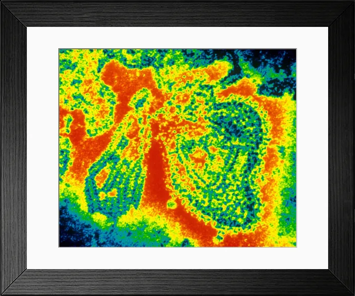 Framed Print : Mumps Virus (TEM) Framed Print : Mumps Virus (TEM)