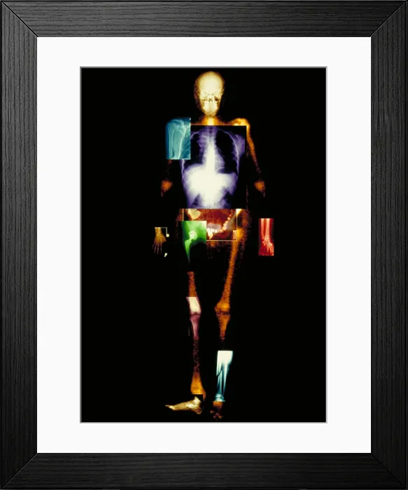 Framed Print : Composite of body