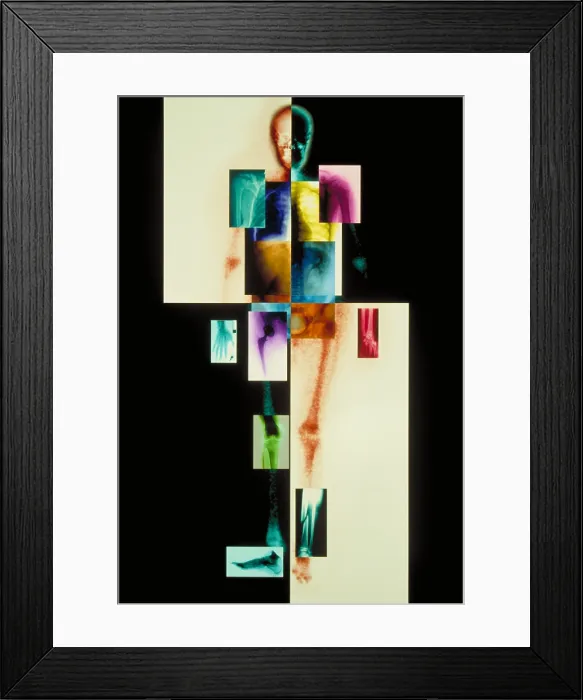Framed Print : Composite of body