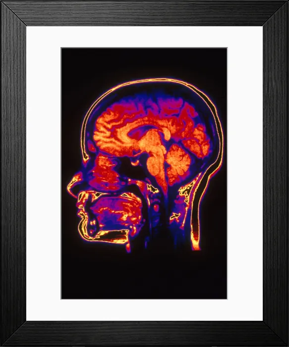 Framed Print : MRI of Head Framed Print : MRI of Head