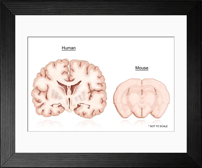 Framed Print : Human and Mouse Brain Comparison Framed Print : Human and Mouse Brain Comparison