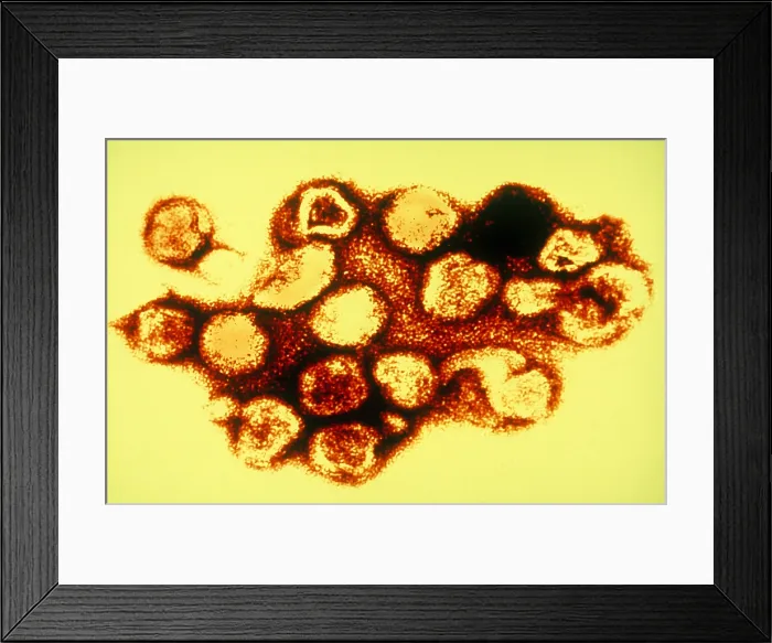 Framed Print : TEM of Rubella (German Measles) Framed Print : TEM of Rubella (German Measles)