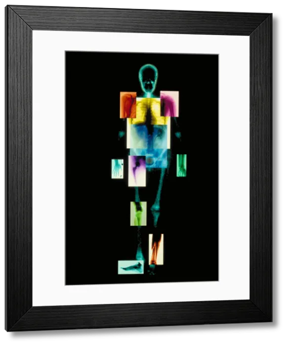 Framed Print : Composite of body Framed Print : Composite of body