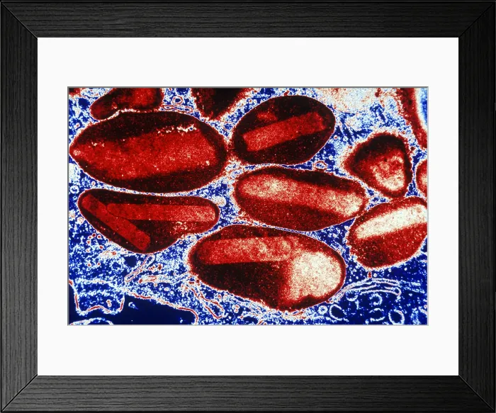 Framed Print : White Blood Cells