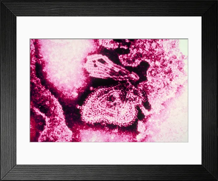 Framed Print : Mumps Virus (TEM)