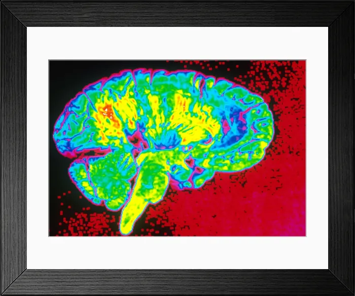 Framed Print : Human Brain Framed Print : Human Brain