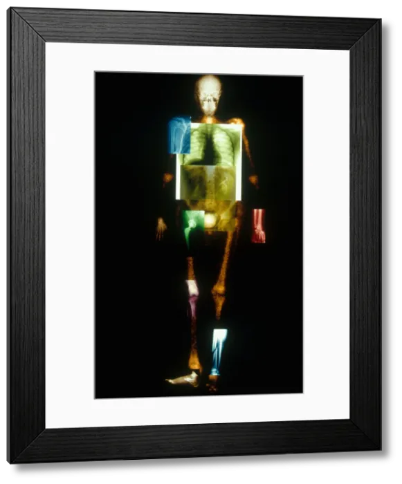 Framed Print : Medical Imaging Montage Framed Print : Medical Imaging Montage