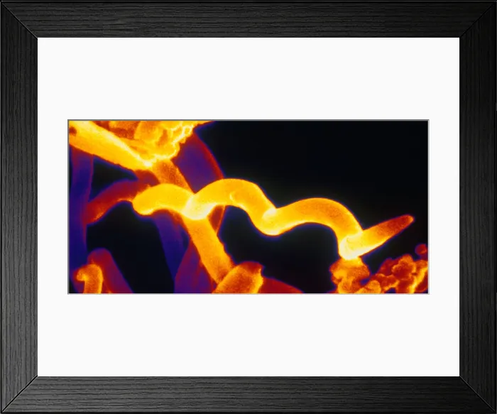 Framed Print : Lyme disease bacteria Framed Print : Lyme disease bacteria