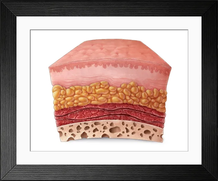 Framed Print : Skin Anatomy, Illustration