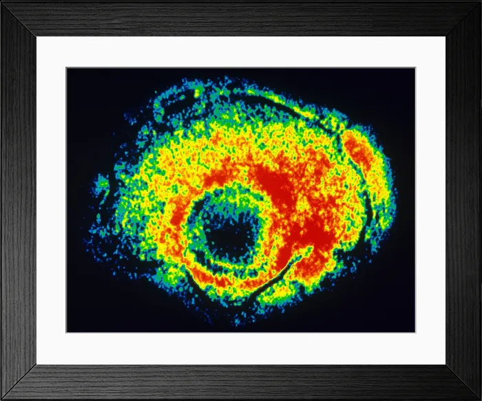 Framed Print : TEM of Varicella Framed Print : TEM of Varicella