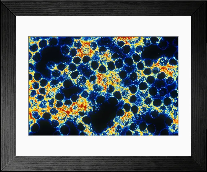 Framed Print : TEM of Yellow Fever Framed Print : TEM of Yellow Fever