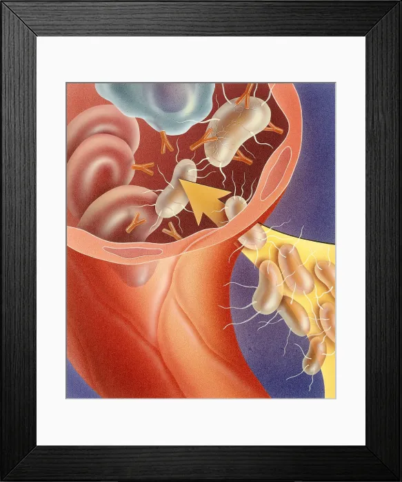 Framed Print : Antigens and antibodies Framed Print : Antigens and antibodies