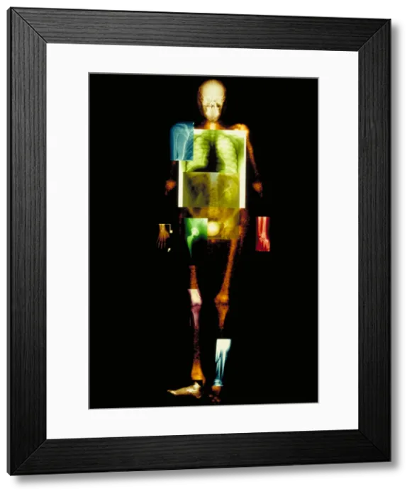 Framed Print : Composite of body