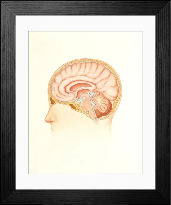 Framed Print : Human brain Framed Print : Human brain