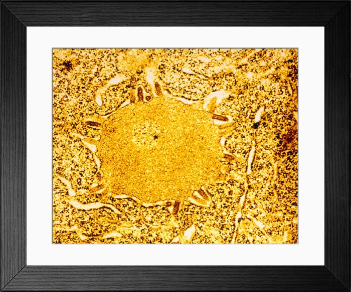 Framed Print : TEM of Negri Body Framed Print : TEM of Negri Body