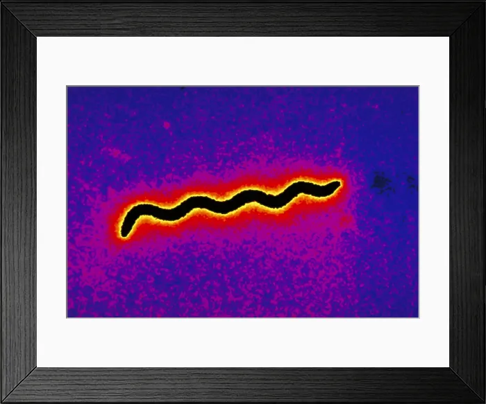 Framed Print : Borellia burgdorferi Framed Print : Borellia burgdorferi