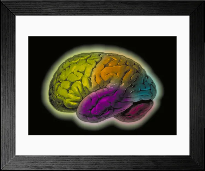 Framed Print : Human brain Framed Print : Human brain