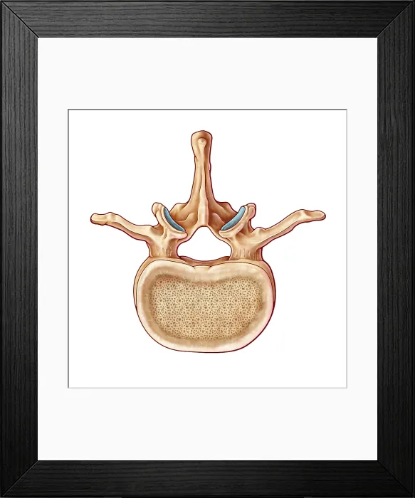 Framed Print : Lumbar Vertebra and Nerves, illustration Framed Print : Lumbar Vertebra and Nerves, illustration
