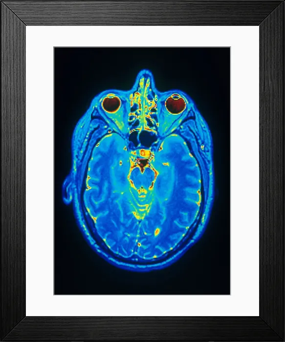 Framed Print : MRI of Brain Framed Print : MRI of Brain