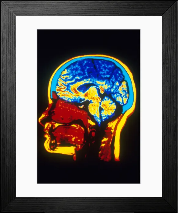 Framed Print : MRI of Head Framed Print : MRI of Head