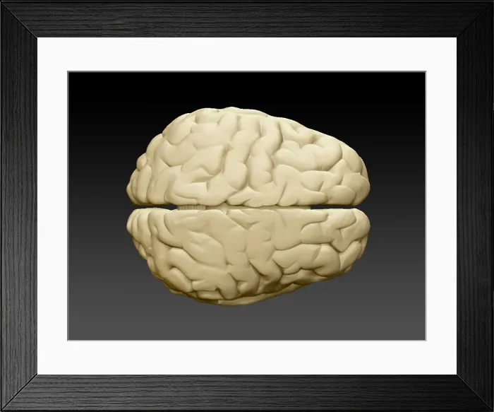 Framed Print : Brain External Anatomy Superior View Framed Print : Brain External Anatomy Superior View