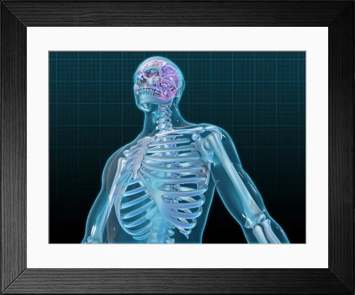 Framed Print : Human Skeleton and Brain, artwork Framed Print : Human Skeleton and Brain, artwork