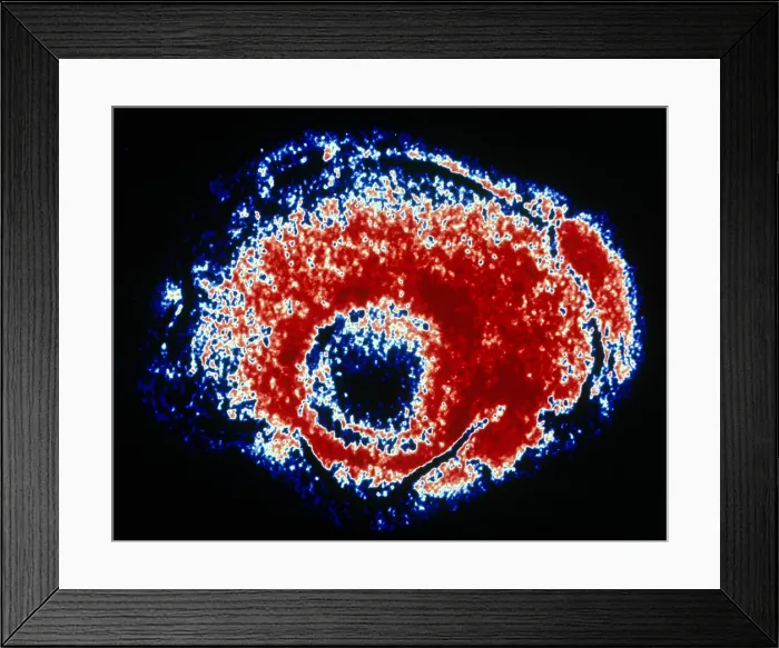 Framed Print : TEM of Varicella Framed Print : TEM of Varicella