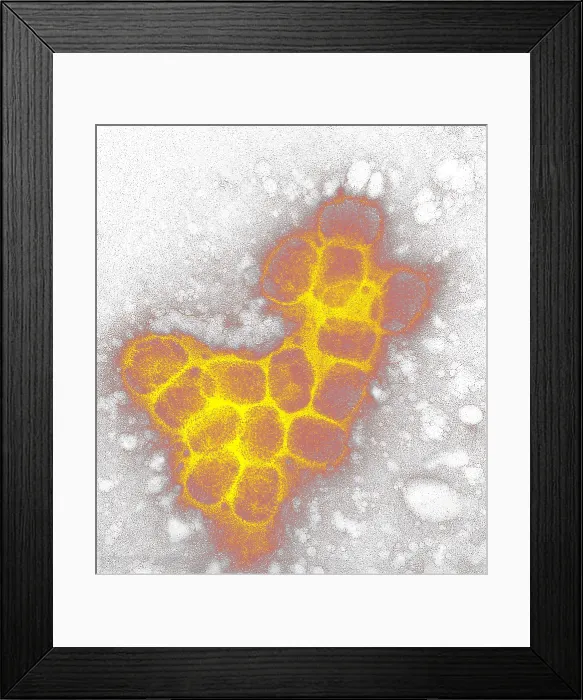 Framed Print : Smallpox virus Framed Print : Smallpox virus