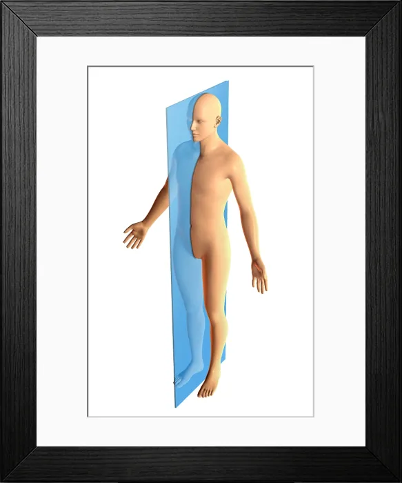Framed Print : Sagittal Plane Framed Print : Sagittal Plane