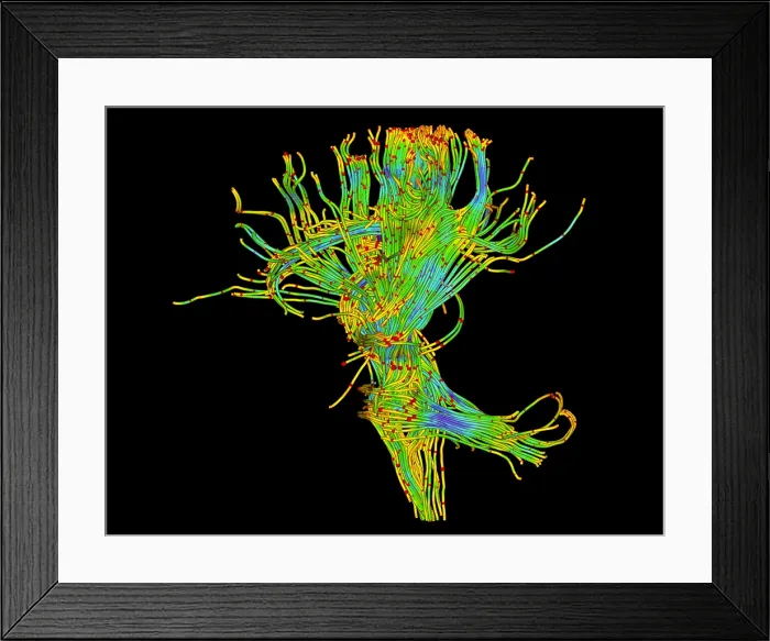 Framed Print : Brain, Fiber Tractography Image