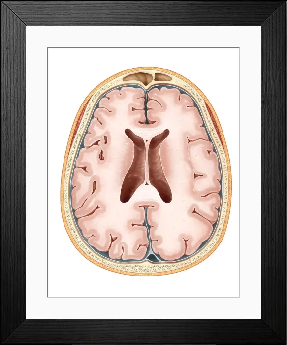 Framed Print : Brain, Transverse Section Framed Print : Brain, Transverse Section