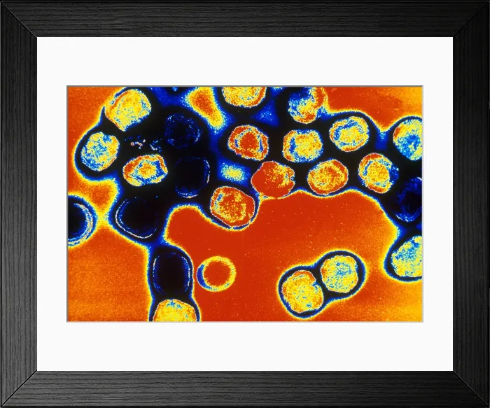 Framed Print : TEM of Vaccinia Virus