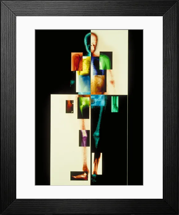 Framed Print : Composite of body