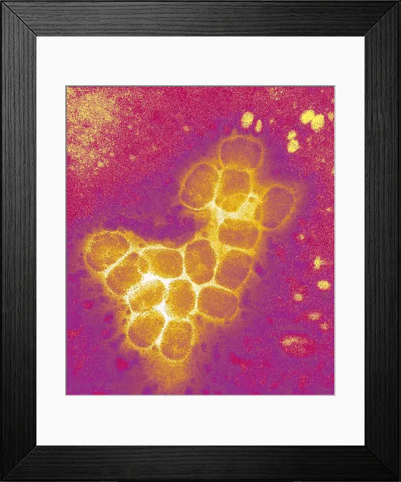Framed Print : Smallpox virus
