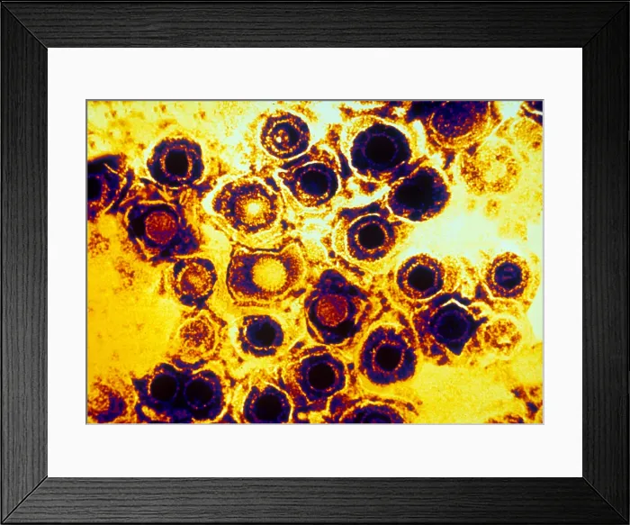 Framed Print : Herpes Simplex Virus (TEM) Framed Print : Herpes Simplex Virus (TEM)