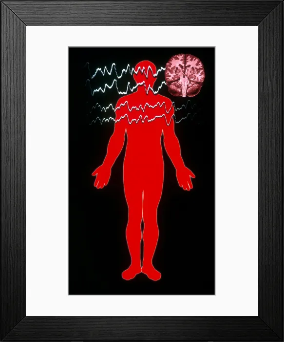 Framed Print : EEG of Tonic-clonic Seizure Framed Print : EEG of Tonic-clonic Seizure