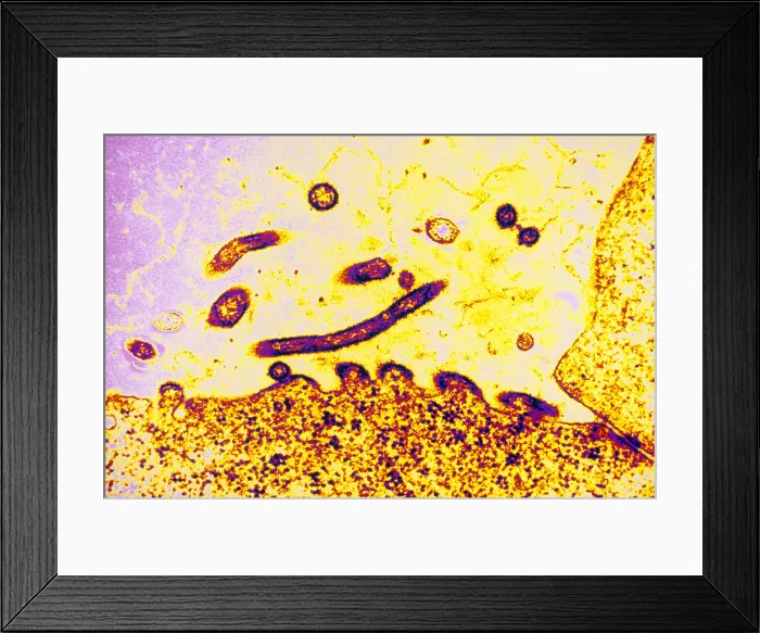 Framed Print : TEM of Respiratory Syncytial Virus Framed Print : TEM of Respiratory Syncytial Virus
