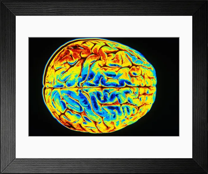Framed Print : Human Brain Framed Print : Human Brain