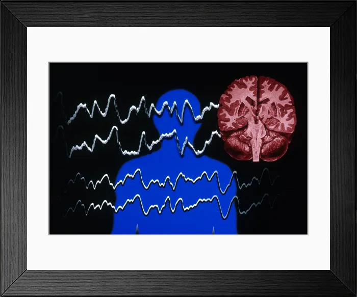 Framed Print : EEG of Tonic-clonic Seizure