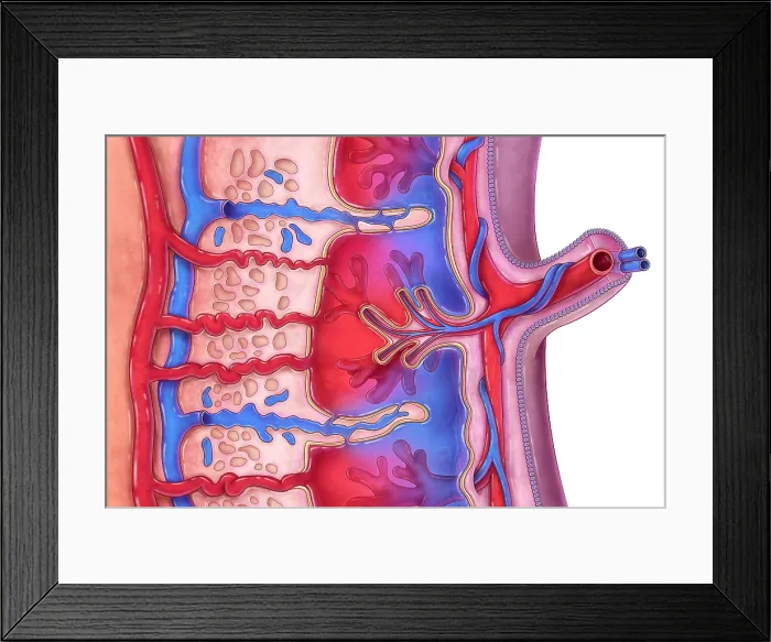 Framed Print : Placenta and Umbilical Cord, illustration Framed Print : Placenta and Umbilical Cord, illustration